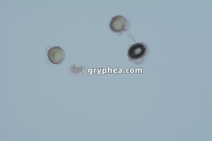 Taenia saginata, oeufs dans déjections x100 - gryphea.org